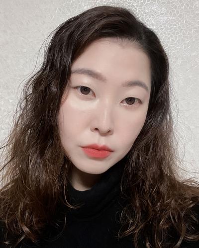 눈밑 꺼짐 8주차, 그늘감 정리되고 표정이 부드러워졌어요 — 아바성형외과 환자 후기 사진