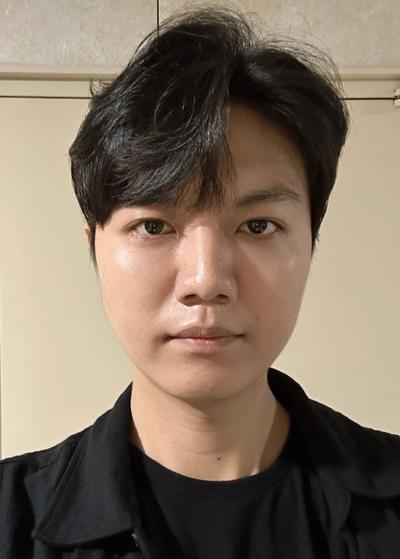 눈밑지방재배치 2주차, 다크서클 완전히 사라졌어요 — 아바성형외과 환자 후기 사진