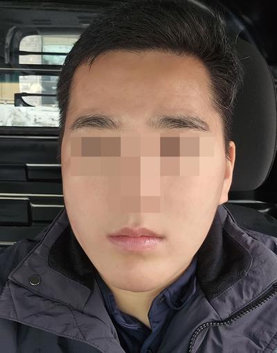 안면거상 8주차, 팔자주름 이중턱 사라져 기분 최고 사진 4 — 아바성형외과 안면거상 후기