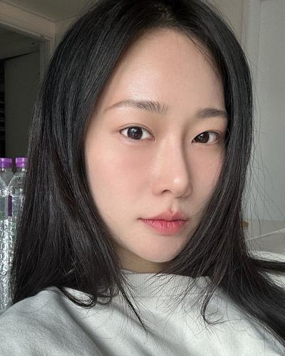 고민만 하다 한 수술, 진작 할 걸 후회해요 만족 만퍼센트 — 아바성형외과 환자 후기 사진