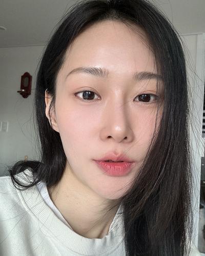 고민만 하다 한 수술, 진작 할 걸 후회해요 만족 만퍼센트 사진 4 — 아바성형외과 쌍꺼풀·눈성형 후기