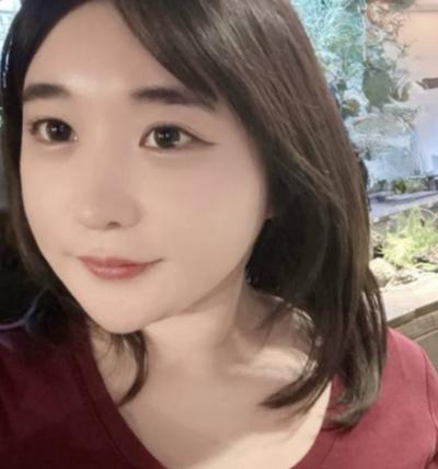얼굴지방흡입 후기, 친구들이 효과 대박이라고 해요 사진 4 — 아바성형외과 이중턱·윤곽 후기