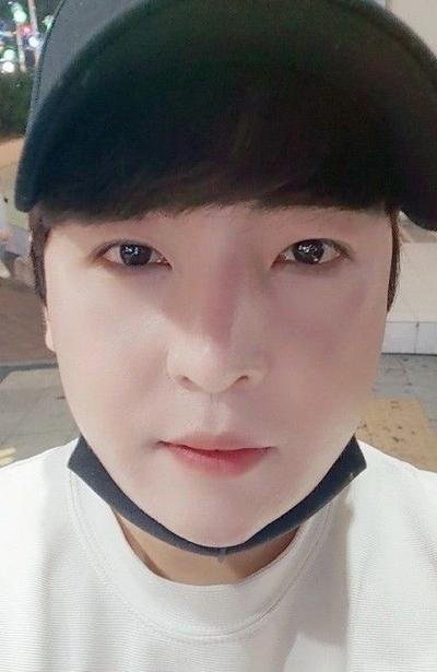 수술 3개월차, 붓기 예쁘게 빠져서 매우 만족합니다 사진 2 — 아바성형외과 기타 후기