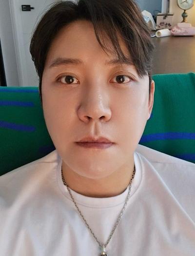 거상 12주차, 붓기 빠지니 흉터도 거의 안 보여요 대만족 — 아바성형외과 환자 후기 사진
