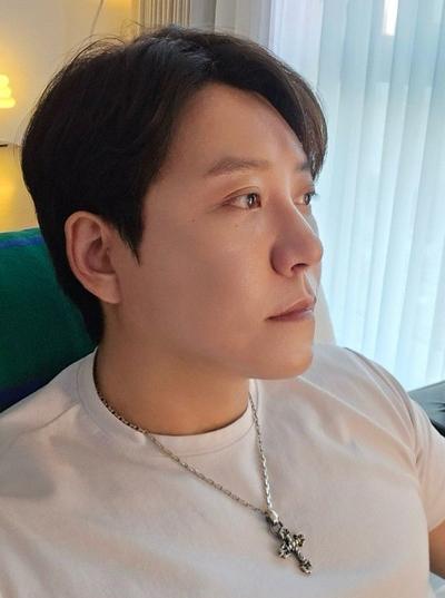 거상 12주차, 붓기 빠지니 흉터도 거의 안 보여요 대만족 사진 4 — 아바성형외과 안면거상 후기