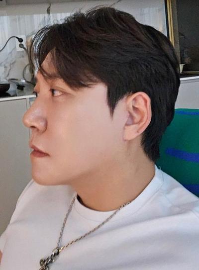거상 12주차, 붓기 빠지니 흉터도 거의 안 보여요 대만족 사진 5 — 아바성형외과 안면거상 후기