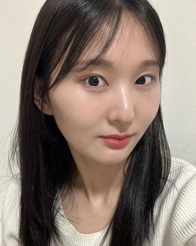 눈밑지방재배치 후 눈밑 볼 다 평평해지고 화장도 진짜 편해요 — 아바성형외과 환자 후기 사진
