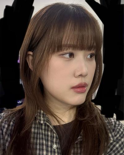 눈밑지방재배치 8주차, 눈밑 고랑 없어져 사진이 만족스러워요 사진 5 — 아바성형외과 눈밑지방재배치 후기