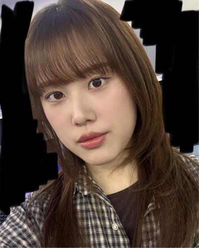 눈밑지방재배치 8주차, 눈밑 고랑 없어져 사진이 만족스러워요 사진 6 — 아바성형외과 눈밑지방재배치 후기