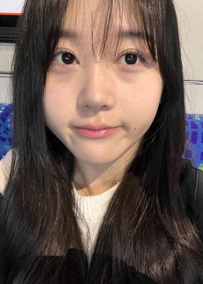 눈밑지방재배치 8주차, 피부 깨끗해졌다는 말 들어요 사진 2 — 아바성형외과 눈밑지방재배치 후기