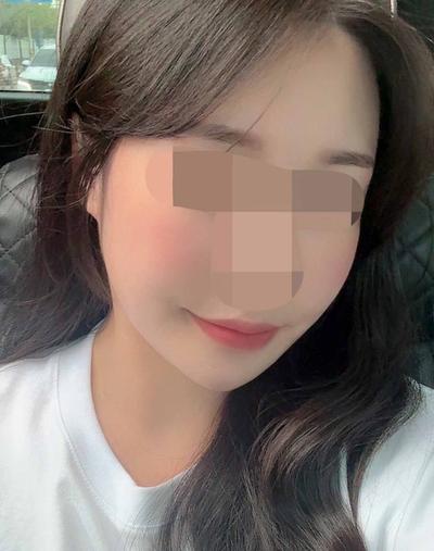 윤곽 재수술＋거상 7주차, 이젠 얼굴형 자랑하기 바빠요 사진 6 — 아바성형외과 안면거상 후기