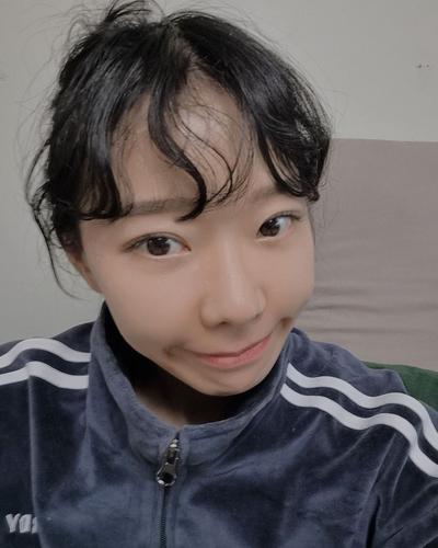 눈밑 수술 10주차, 전후사진 차이에 인상이 맑아졌어요 — 아바성형외과 환자 후기 사진