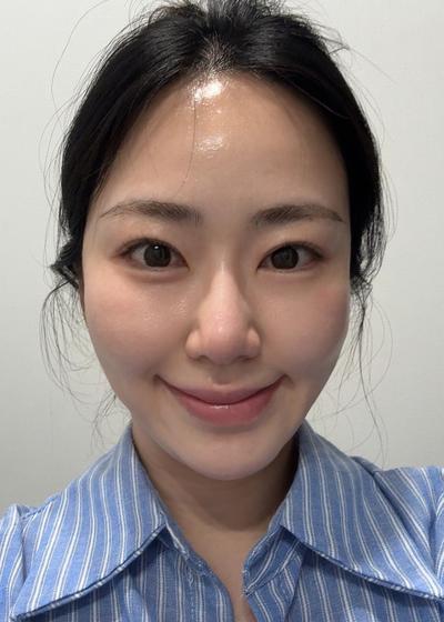 상담 당일 수술 날짜 잡았고 회복도 빨라서 너무 만족 사진 2 — 아바성형외과 기타 후기