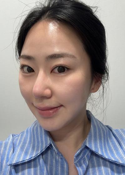 상담 당일 수술 날짜 잡았고 회복도 빨라서 너무 만족 사진 3 — 아바성형외과 기타 후기