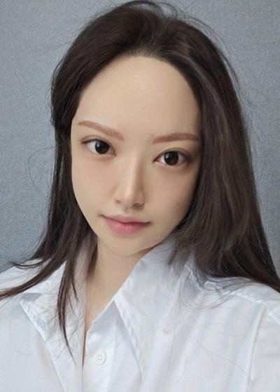 눈성형 환자 후기 — 브라운성형외과 김승수원장님 ... (83)