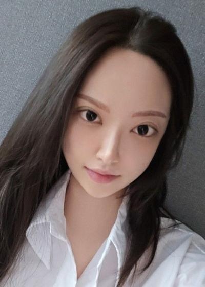 눈밑지방재배치 2주차, 오래 고민했는데 진작 할 걸 그랬어요 사진 4 — 아바성형외과 눈밑지방재배치 후기