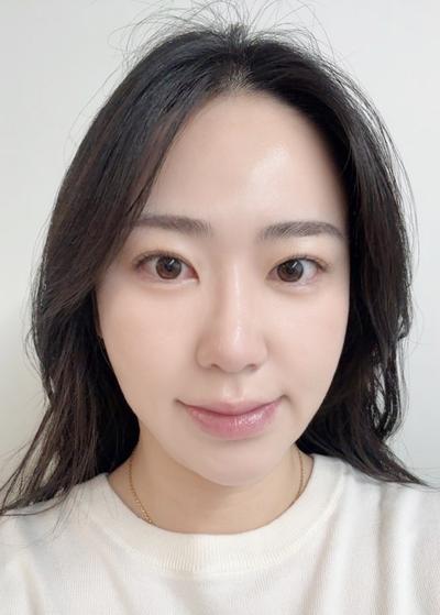 눈성형 환자 후기 — 브라운성형외과 김승수원장님께... (86)