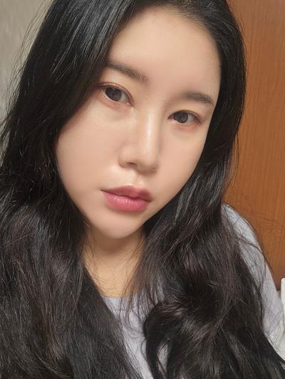 눈밑지방재배치 8주차, 짝짝이 정리되고 화장이 훨씬 편해요 사진 3 — 아바성형외과 눈밑지방재배치 후기