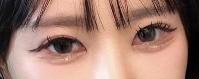눈밑지방재배치 3주차, 어려보인다는 말 듣고 컨실러도 끊었어요 — 아바성형외과 환자 후기 사진