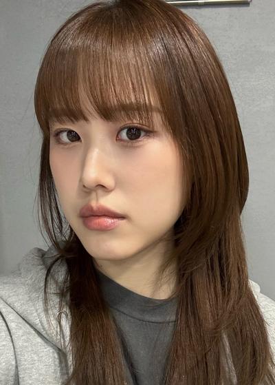 눈밑지방재배치 4주차, 다크서클 커버되고 안색 확 밝아졌어요 사진 6 — 아바성형외과 눈밑지방재배치 후기