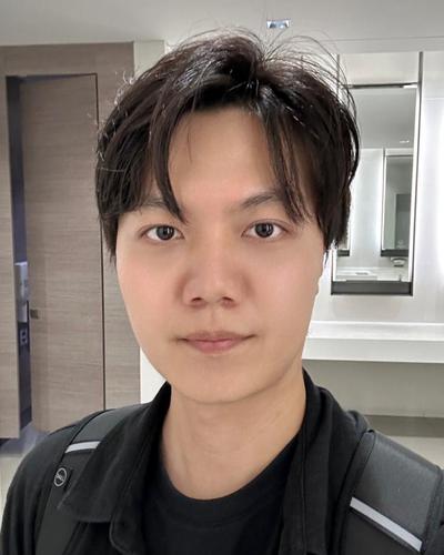 눈수술 14주차, 늘 고민이던 다크서클 해결돼서 대만족 — 아바성형외과 환자 후기 사진