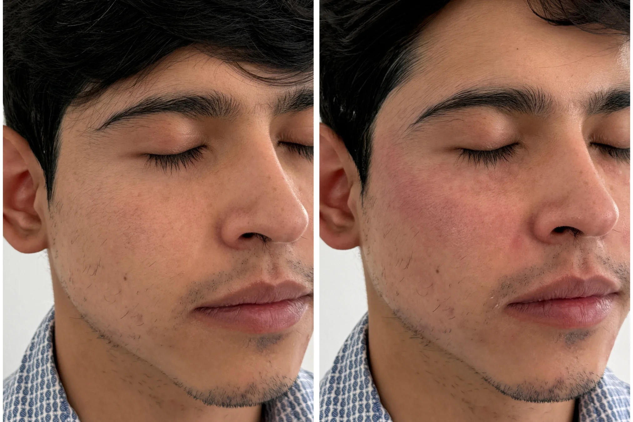 Resultado de Bioestimulación Masculina