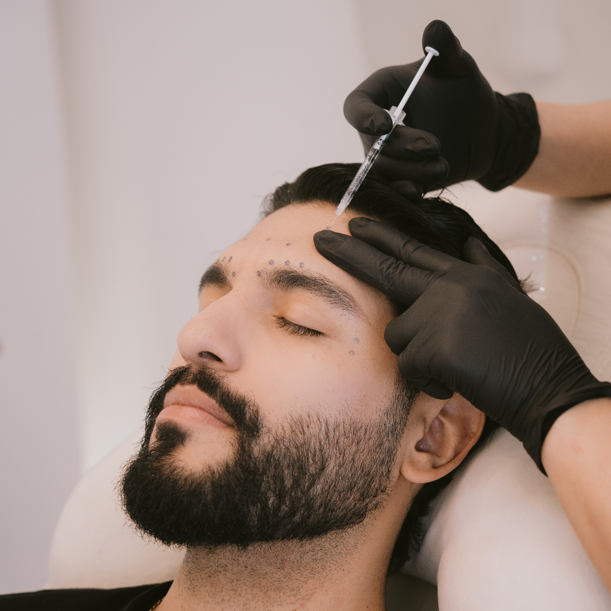 Botox para Hombres (Botox)