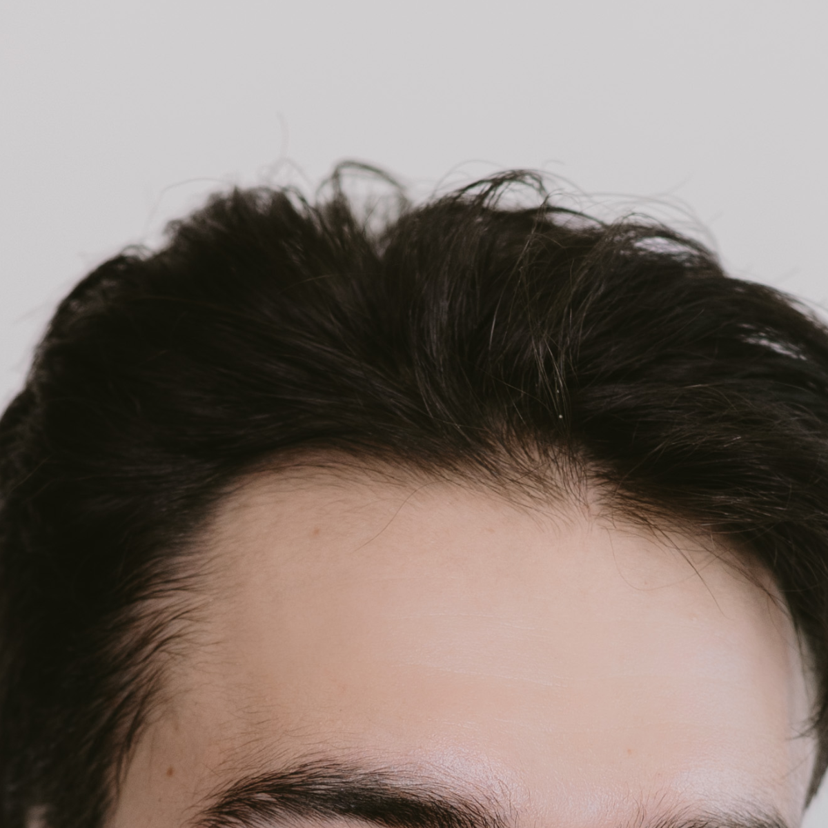 Terapia Capilar Masculina
