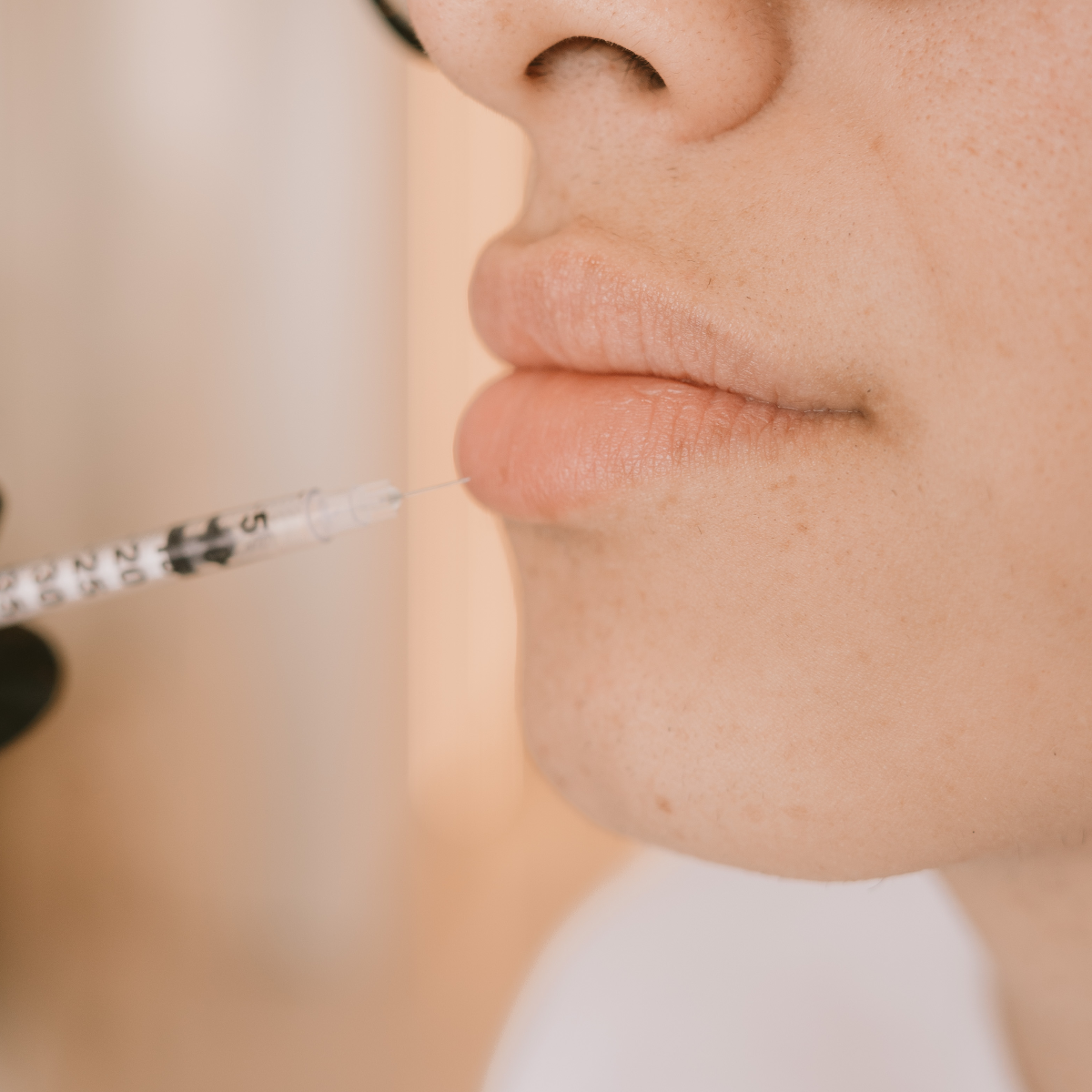 Lip Filler para Él