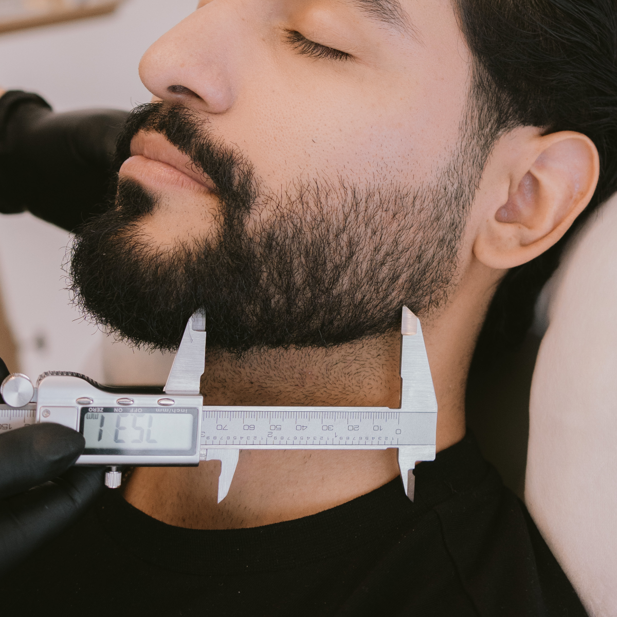 Masculinización Facial