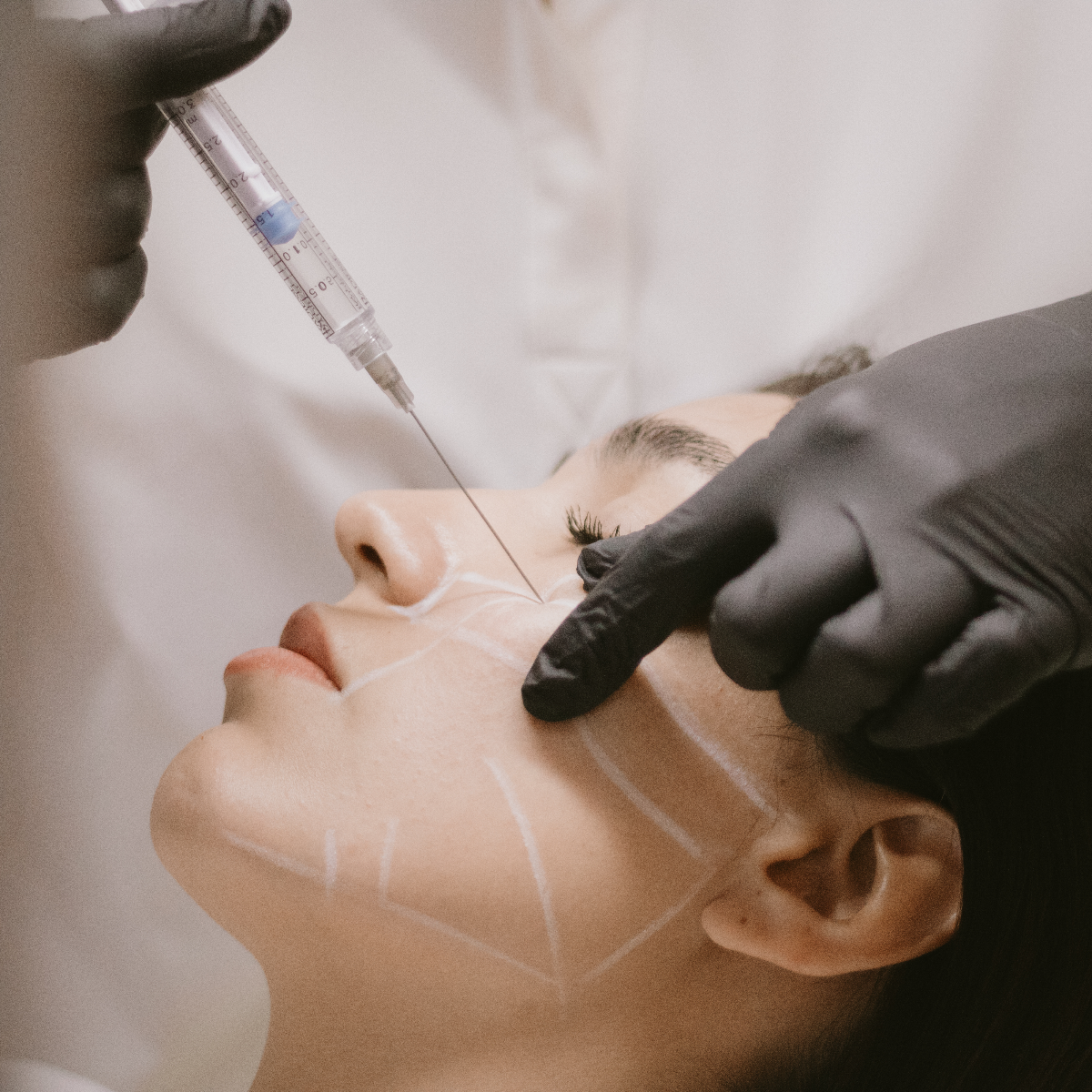 Bioestimulación