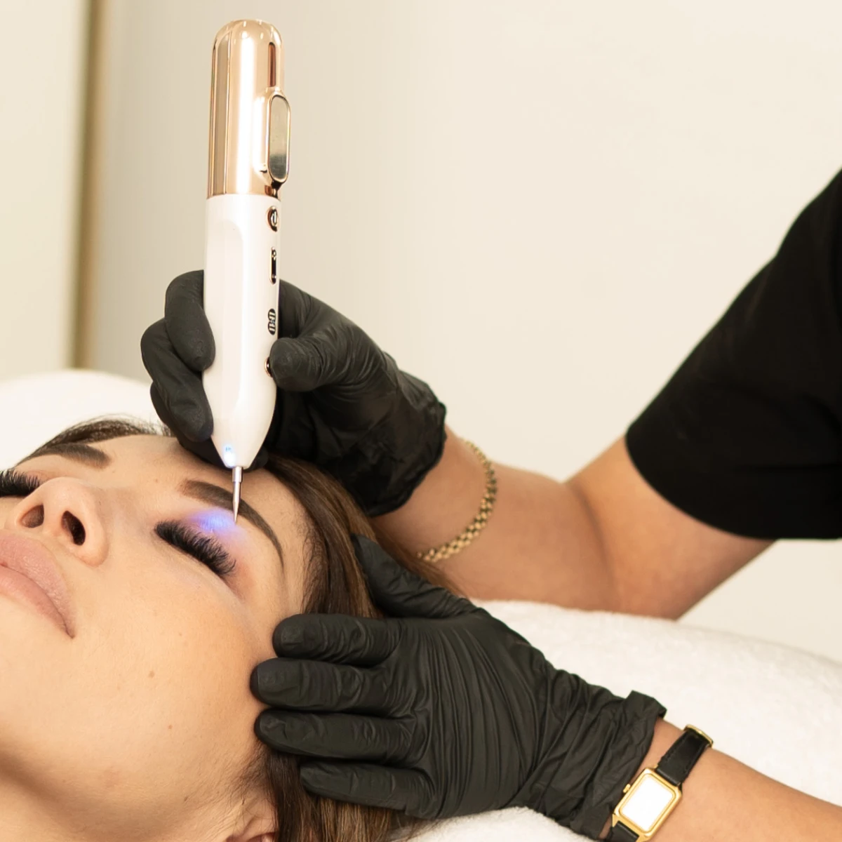 Plasmapen Fibroblast