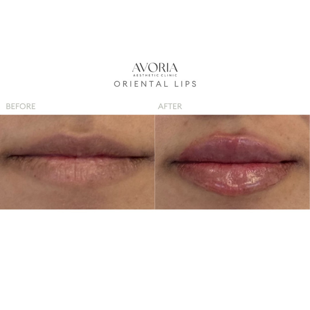 Oriental Lips