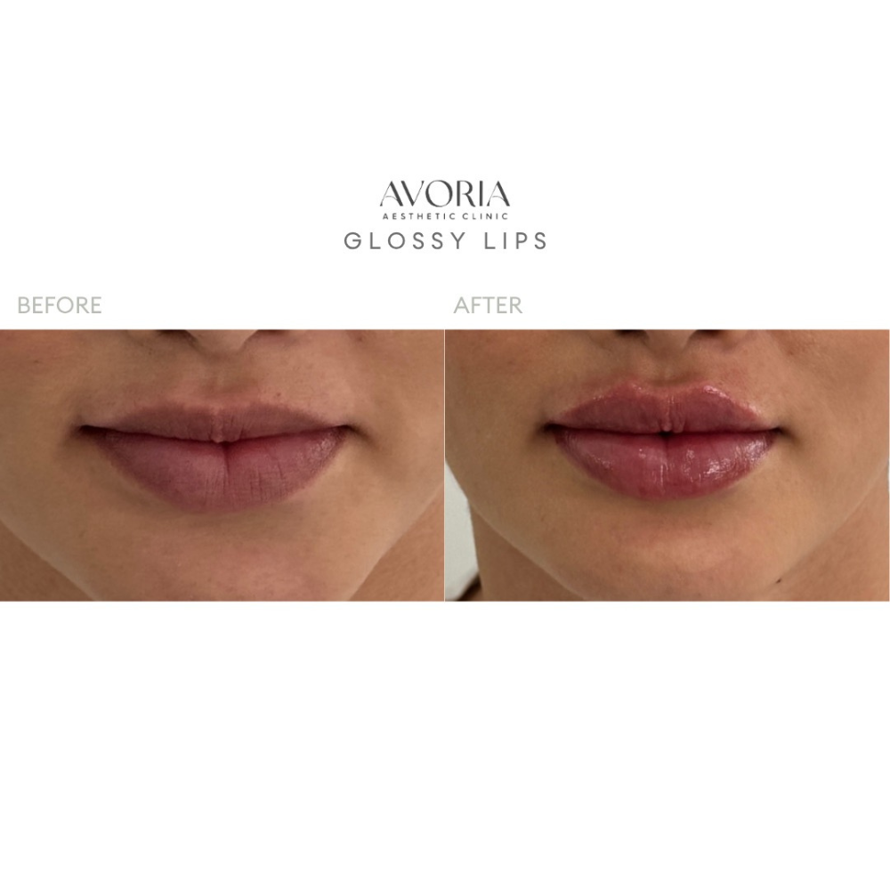 Glossy Lips