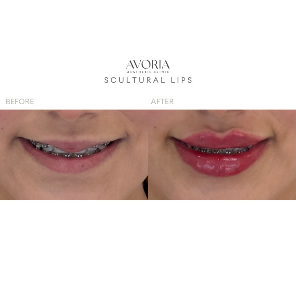 Scultural Lips