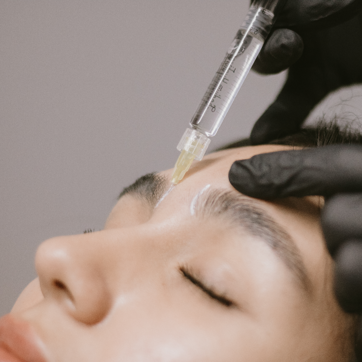 Skinbooster (Hidratación Dérmica)