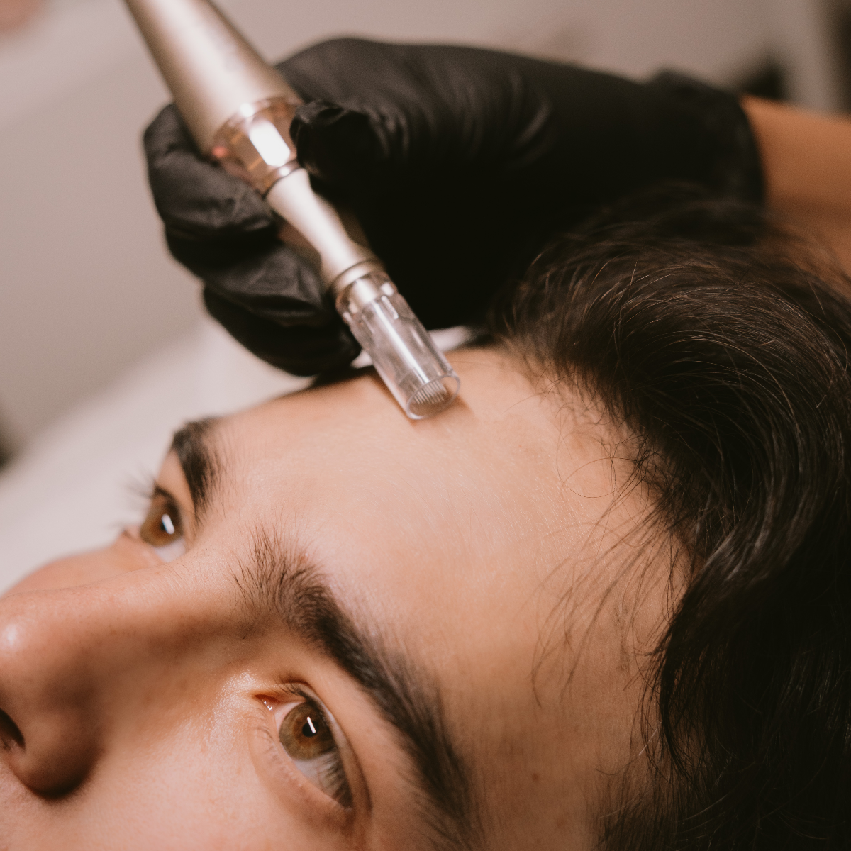 Dermapen