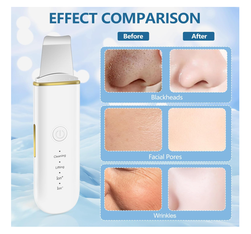ACWOO Épurateur De Peau