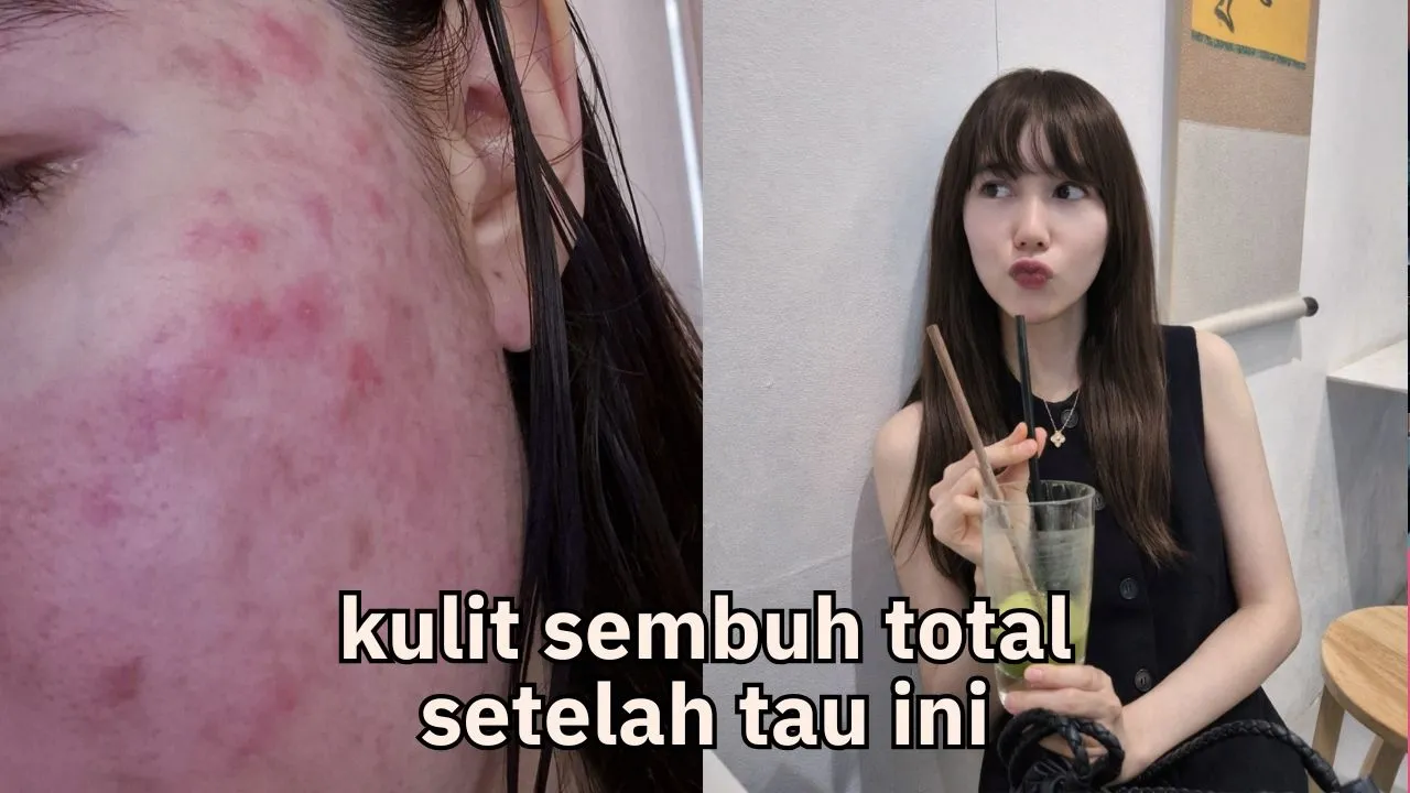 Kulit Sembuh Tuntas Secara Scientific