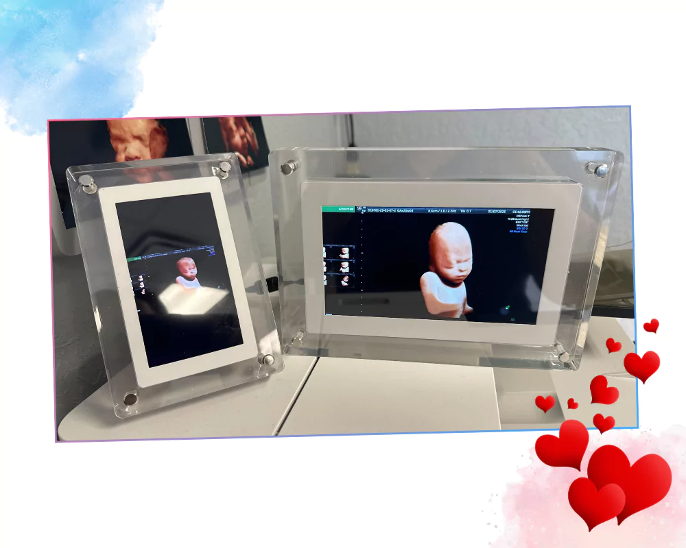A close-up of an Ultrasound Video Frame playing a heartbeat recording, decorated with soft Valentine’s colors