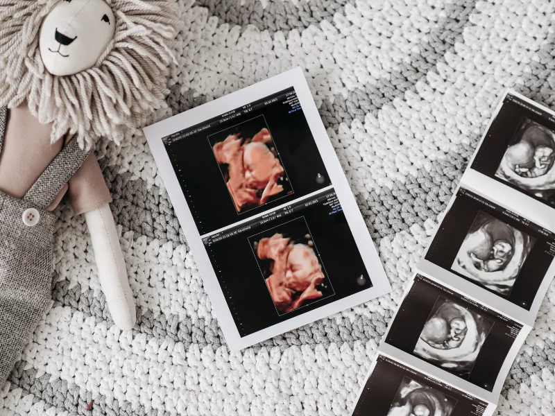 Close-up of ultrasound photos on a cozy white and grey crocheted mat – affordable 3D/4D ultrasound images from Baby Fairytale, capturing special pregnancy moments.