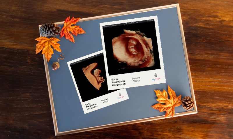 Two ultrasound photos in a Thanksgiving-themed frame on a rustic wooden table, capturing baby's first moments during the holiday season.