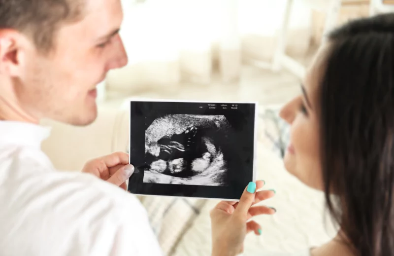 Smiling couple holding a sonogram photo, symbolizing the excitement and anticipation of parenthood during pregnancy.