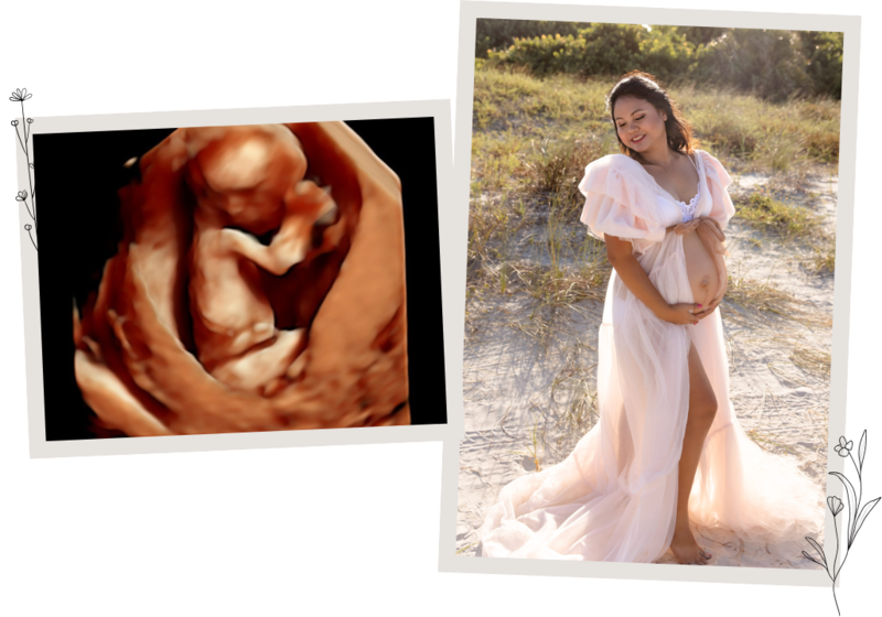 3D/4D and HDLive ultrasounds at Baby Fairytale