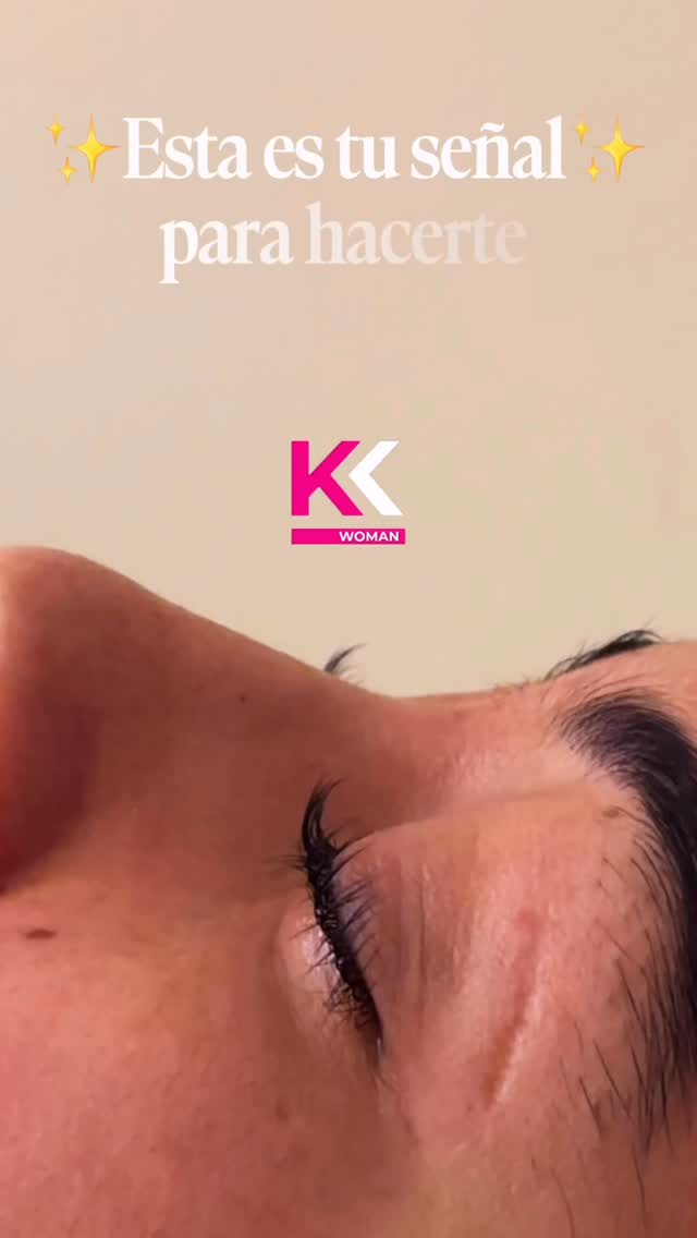 ✨esta es tu señal ✨

Porque sí… despertar viéndote linda también cuenta 😌💅
Cero esfuerzo, mirada perfecta 24/7 ✨

Agenda tu cita antes que no queden horas 👀

#KronnosWoman #LiftingDePestañas #GirlMood #GlowUp #CleanGirl en Kronnos Woman, Limache