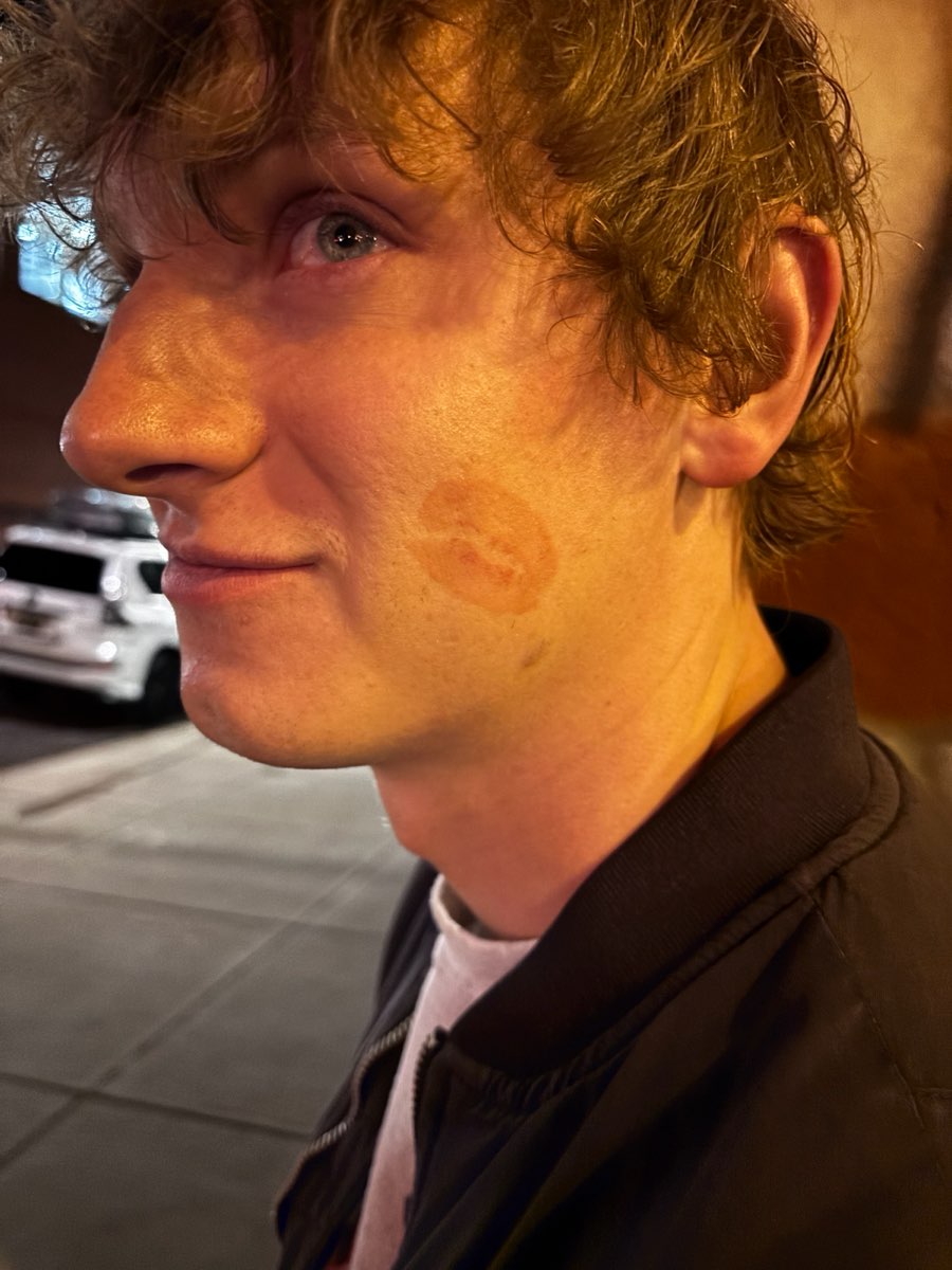 Zdjęcia polowania na padlinożerców na Uniwersytecie w Denver