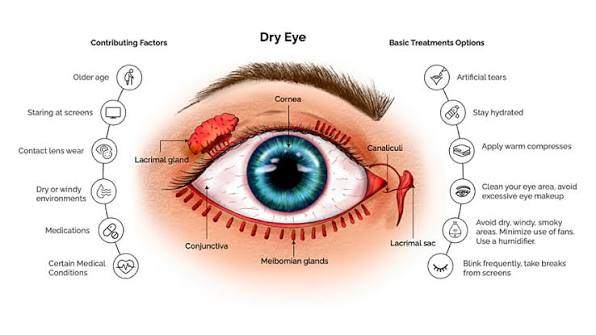 Dry Eye Diagnosis & Treatment
