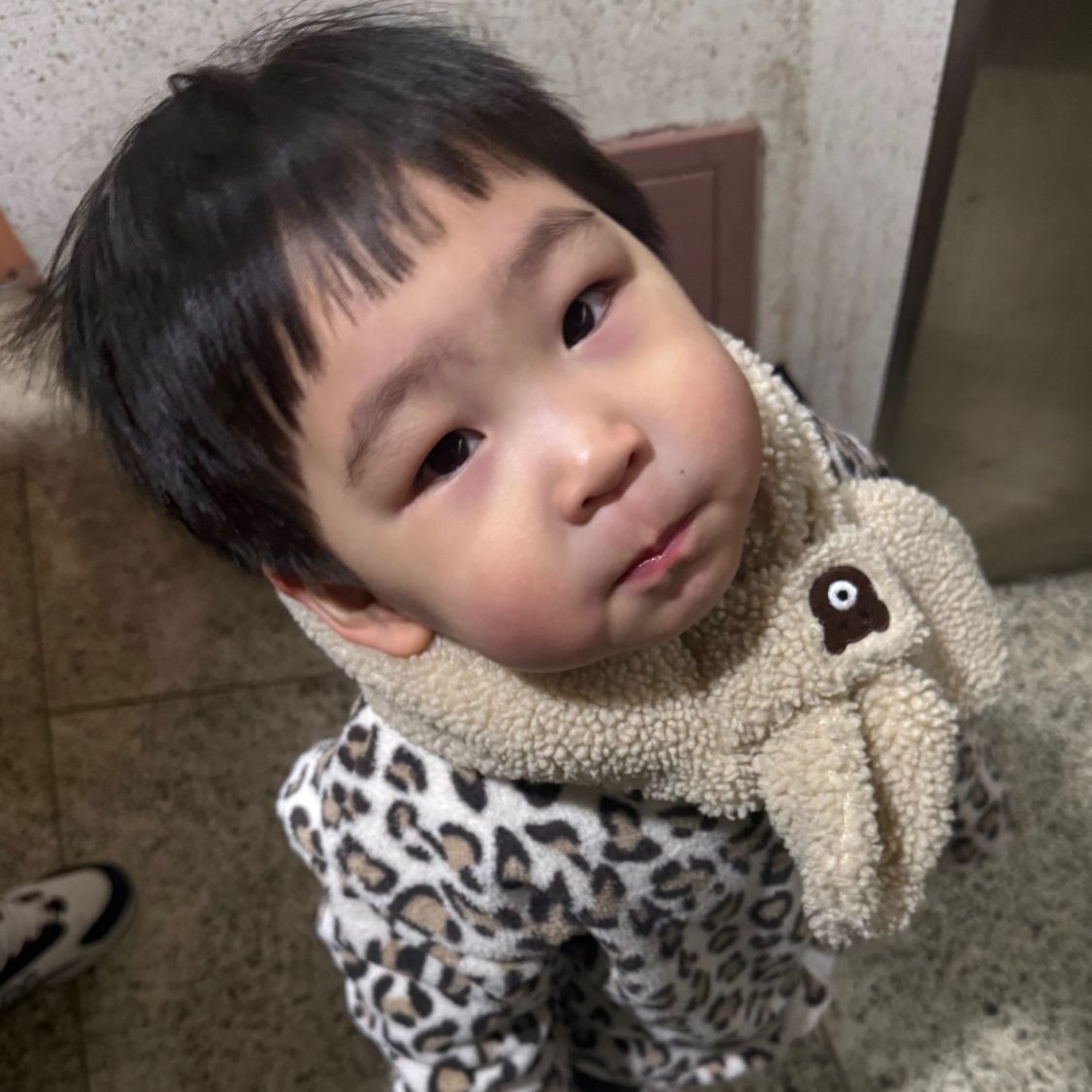 시술 5