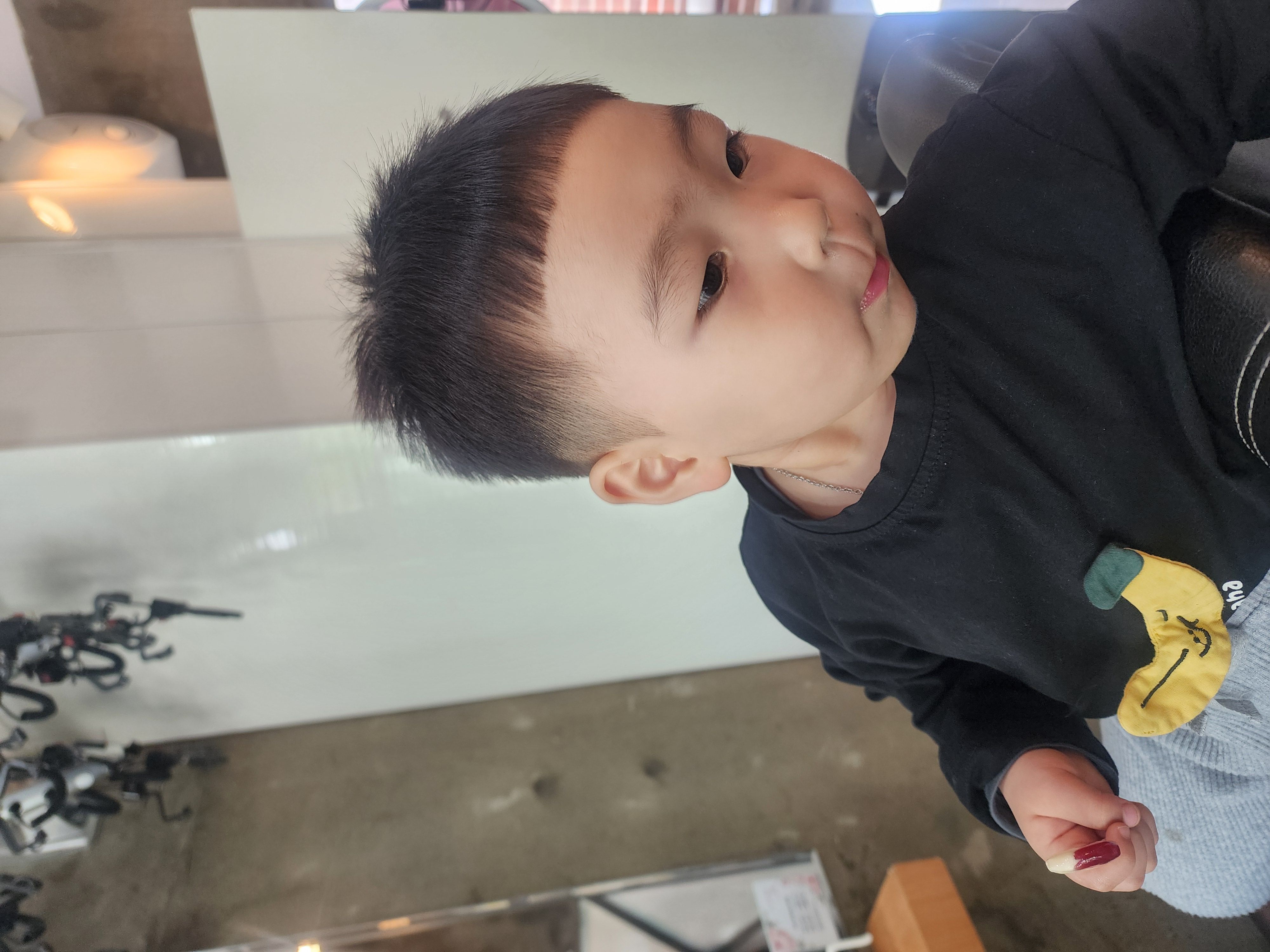 시술 3