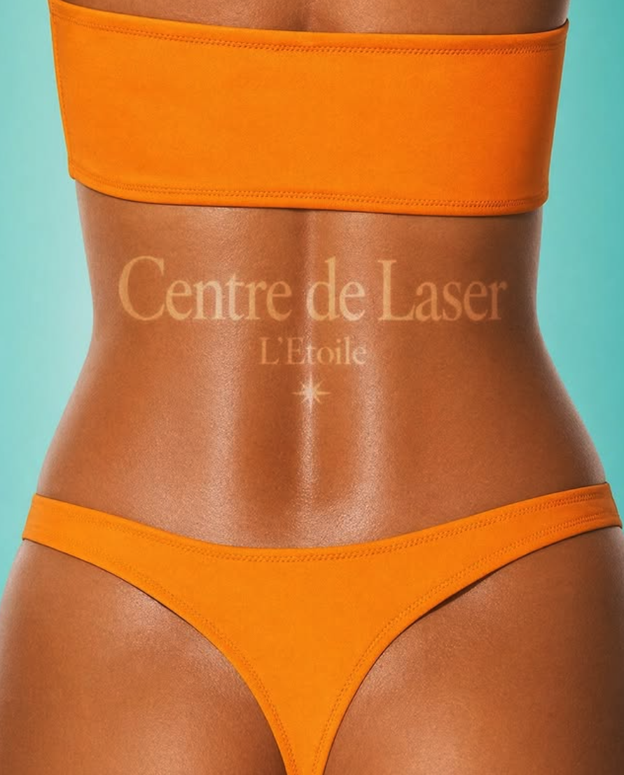 CENTRE LASER L'ÉTOILE 5
